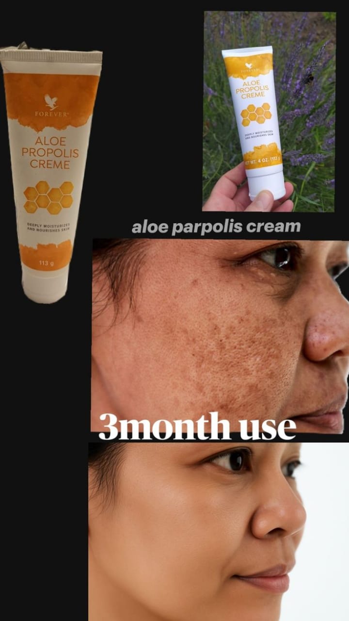 Forever Aloe Propolis Creme (ফরএভার অ্যালো প্রোপোলিস ক্রিম) - Image 7