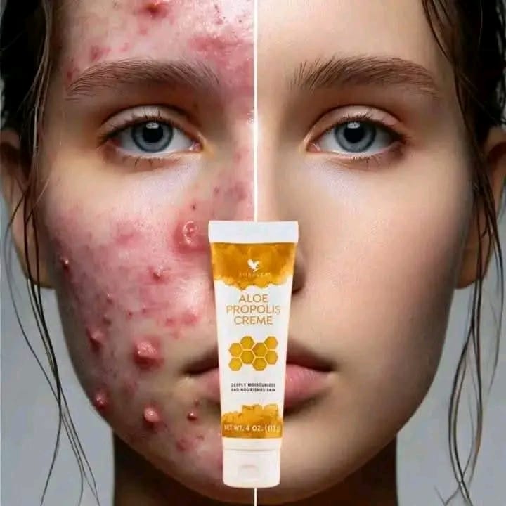 Forever Aloe Propolis Creme (ফরএভার অ্যালো প্রোপোলিস ক্রিম) - Image 9