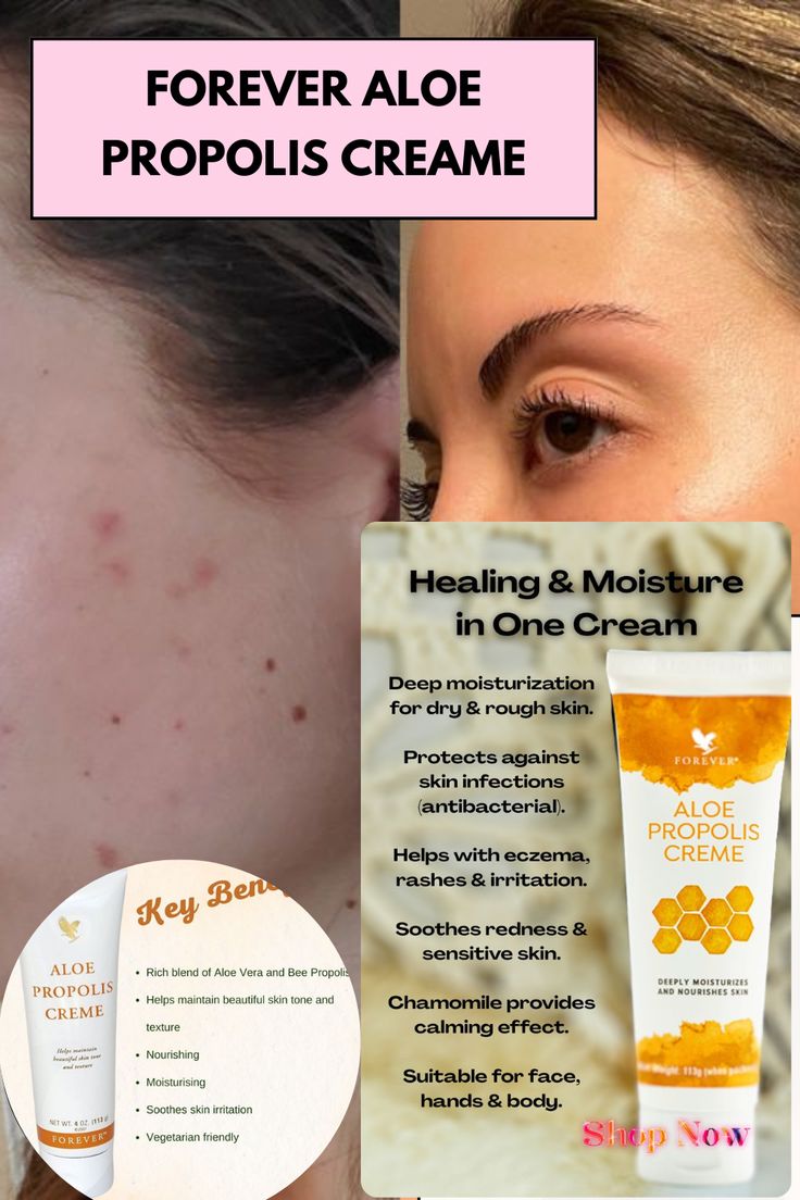 Forever Aloe Propolis Creme (ফরএভার অ্যালো প্রোপোলিস ক্রিম) - Image 4